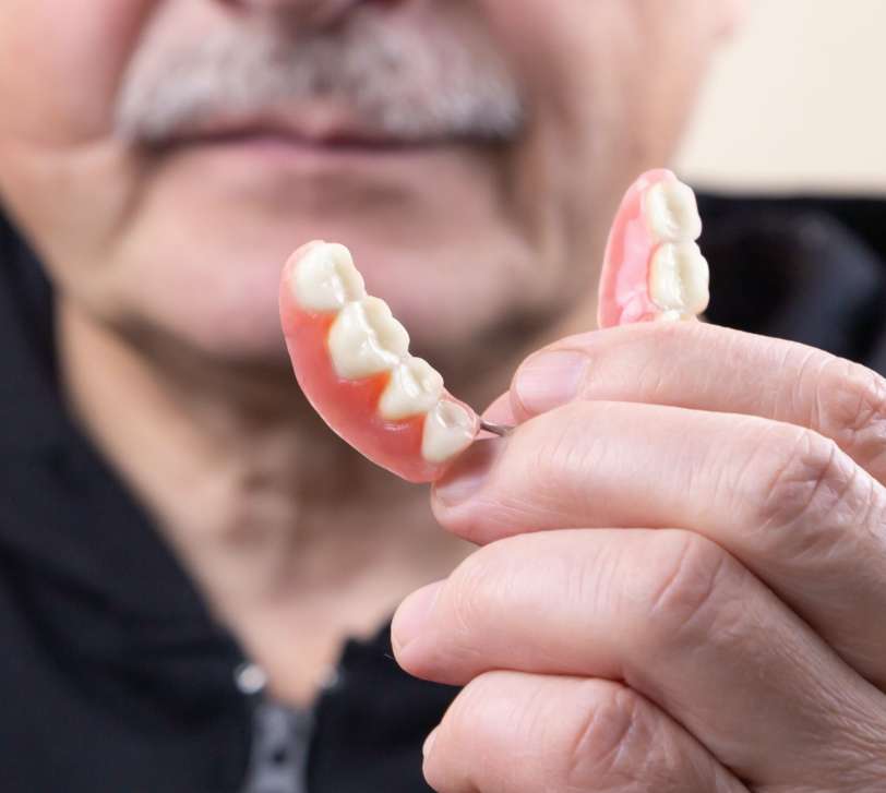 Drill Dental Bar package snap in denture