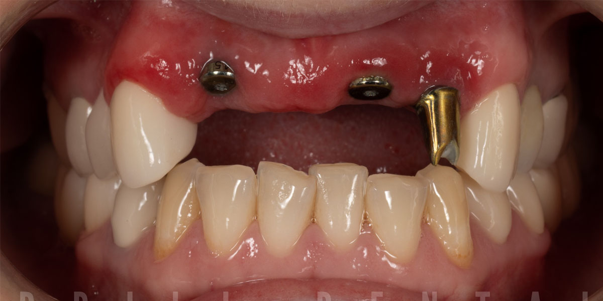 Real patient before photo #9