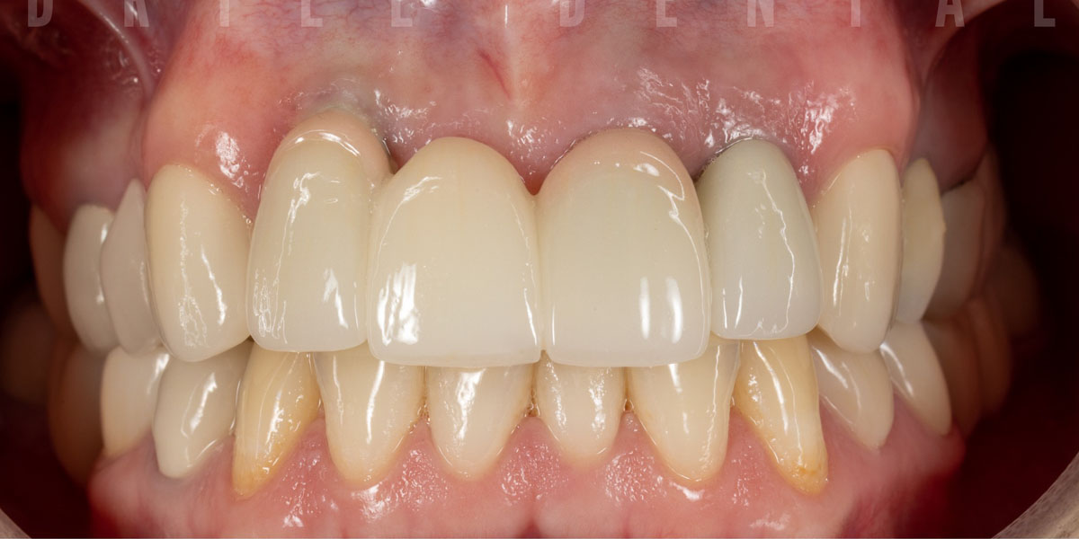 Real patient after photo #9