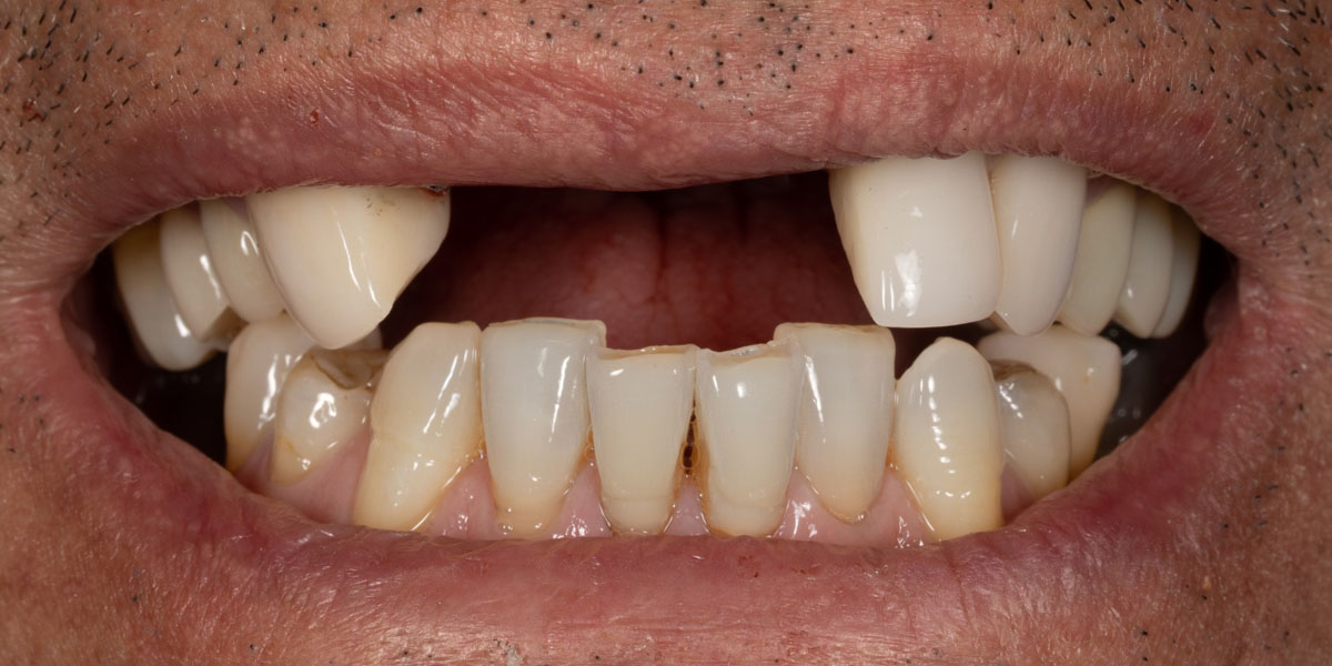 Real patient before photo #6
