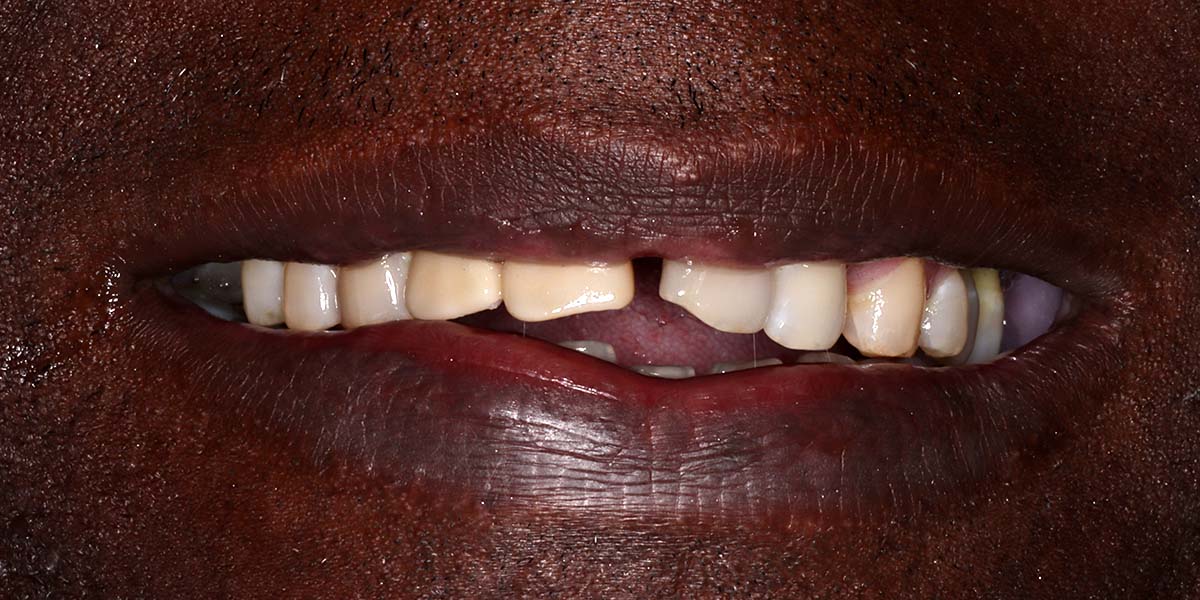 Real patient after photo #7